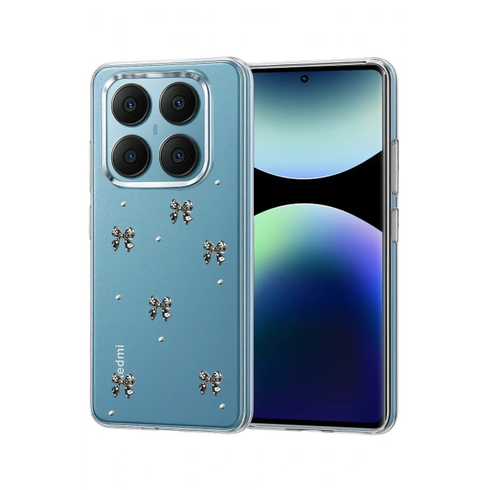 Durukar®   Redmi Note 14 Pro 4G Fiyonk Desenli Kapak - Desen 5