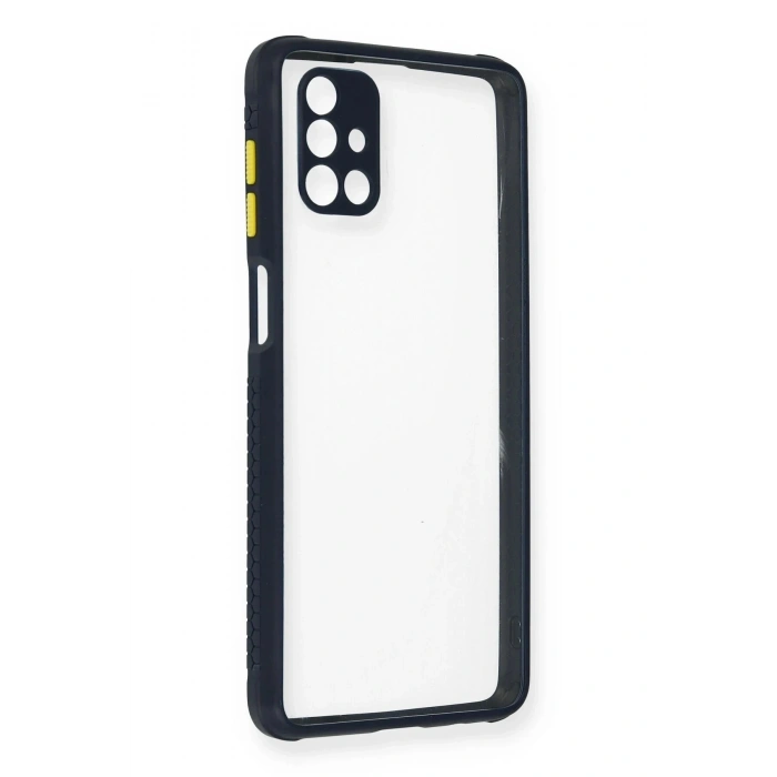 Durukar®  Samsung Galaxy M51 Kılıf Miami Şeffaf Silikon - Lacivert
