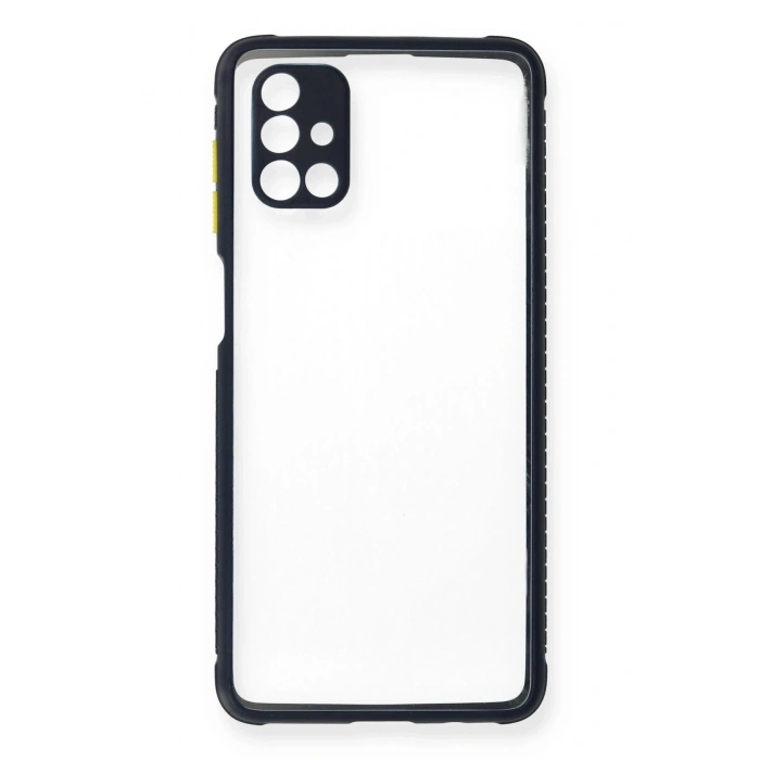 Durukar®  Samsung Galaxy M51 Kılıf Miami Şeffaf Silikon - Lacivert