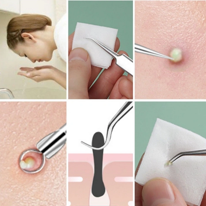 Durukar®11 Parça Siyah Nokta Temizleyici Cilt Bakım Komedon Seti