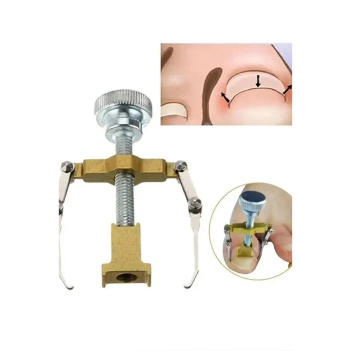 Ergonomik Paslanmaz Çelik Batık Tırnak Düzeltici Aparat