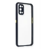 Durukar®  Realme 7 Pro Kılıf Miami Şeffaf Silikon - Lacivert