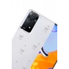 Durukar®   Redmi Note 11 Pro Bow Patterned Case - Pattern 5