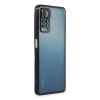 Durukar®   Redmi Note 11 Pro Kılıf  Lensli Silikon - Siyah