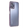 Durukar®   Redmi Note 12 5G Kılıf  Lensli Silikon - Mor