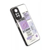 Durukar®   Redmi Note 11 Pro Kılıf Mirror Desenli Kapak - Mirror - 4