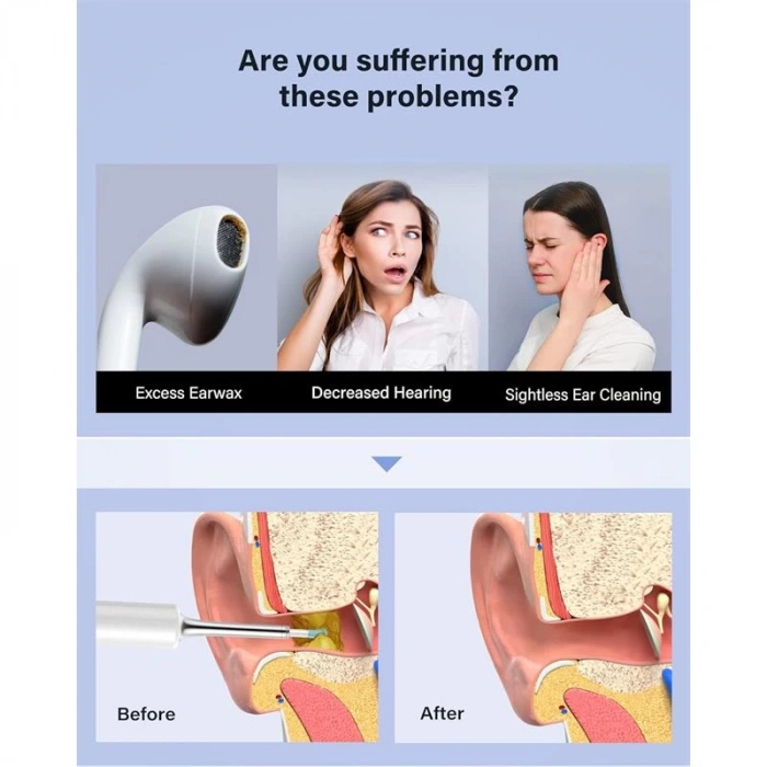 Bebırd T5 3mp Kamera 3.5mm Lens Şarjlı Wıfı Görüntülü Kulak Temizleyici Beyaz Renk