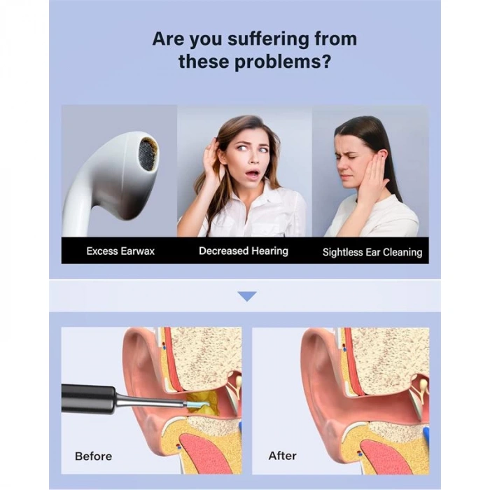 Bebırd T5 3mp Kamera 3.5mm Lens Şarjlı Wıfı Görüntülü Kulak Temizleyici Siyah Renk