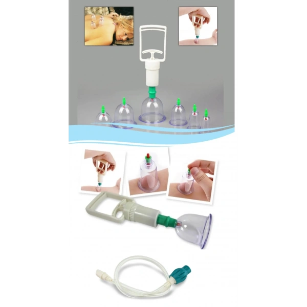 Hacamat Seti Hortumlu - Vakumlu Hortumlu Kupa Çekme Seti (Model 1)