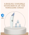 Güçlü Vakumlu Siyah Nokta Temizleyici – Cilt Pürüzlerini Gideren