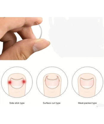 BAŞ PARMAK TIRNAK BATMASINI ENGELLEYEN METAL APARAT NRD 603 ***