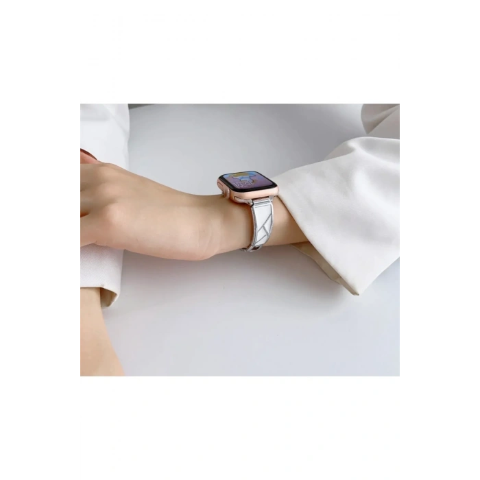 Apple Watch Uyumlu Fashion Loop Kordon