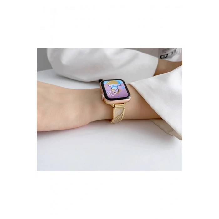 Apple Watch Uyumlu Fashion Loop Kordon