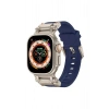 Apple Watch Uyumlu Fuyang Loop Kordon