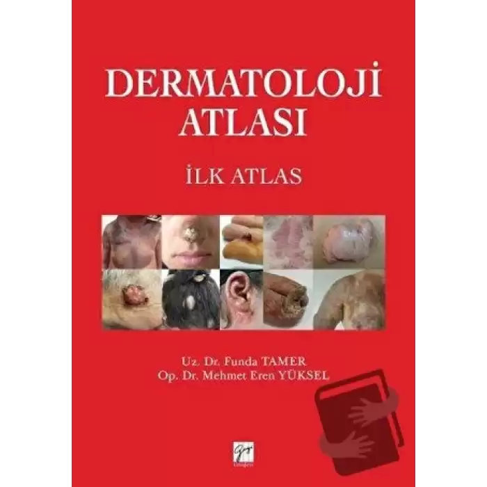 Dermatoloji Atlası