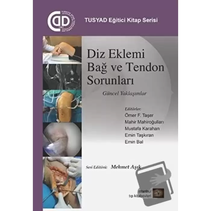 Diz Eklemi Bağ ve Tendon Sorunları