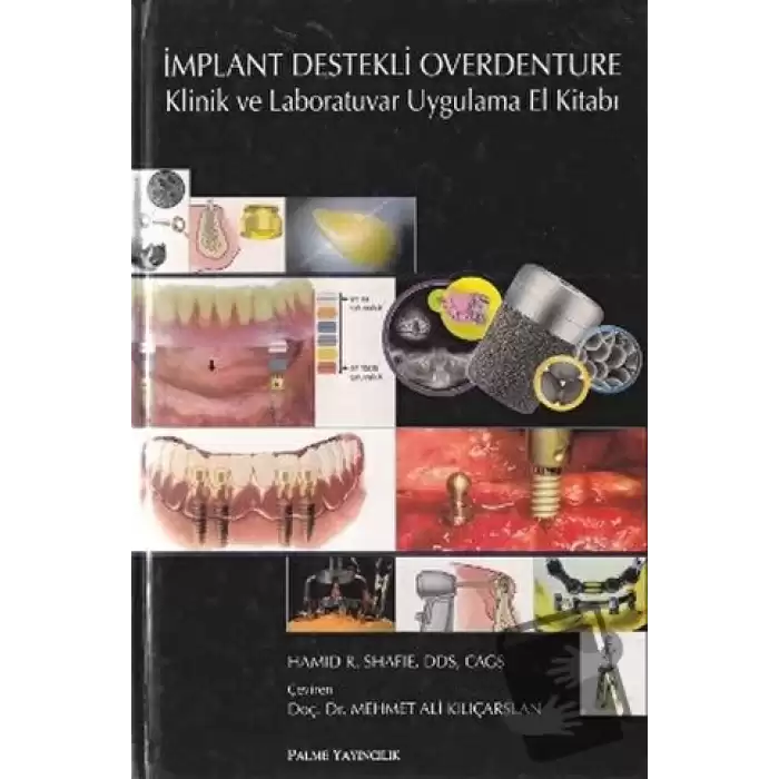 İmplant Destekli Overdenture (Ciltli)