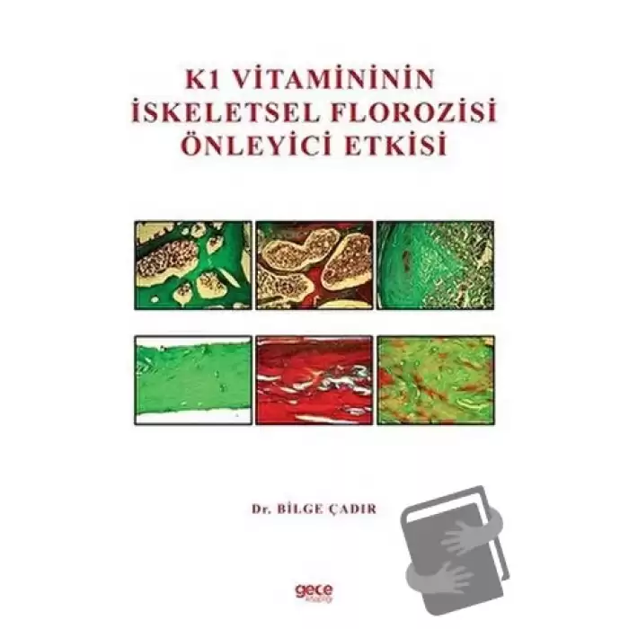 K1 Vitamininin İskeletsel Florozisi Önleyici Etkisi