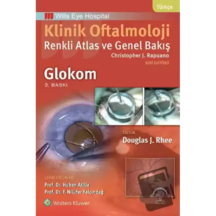 Klinik Oftalmoloji: Renkli Atlas ve Genel Bakış - Glokom