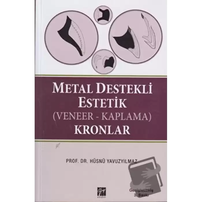 Metal Destekli Estetik (Veneer-Kaplama)Kronlar (Ciltli)