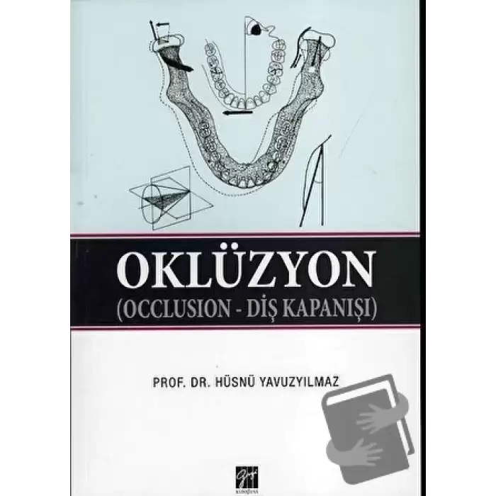 Oklüzyon