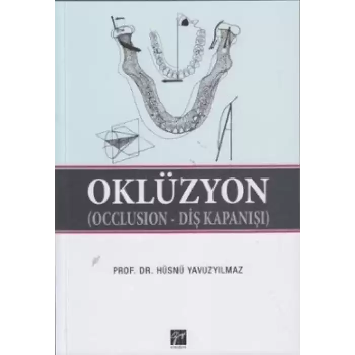 Oklüzyon