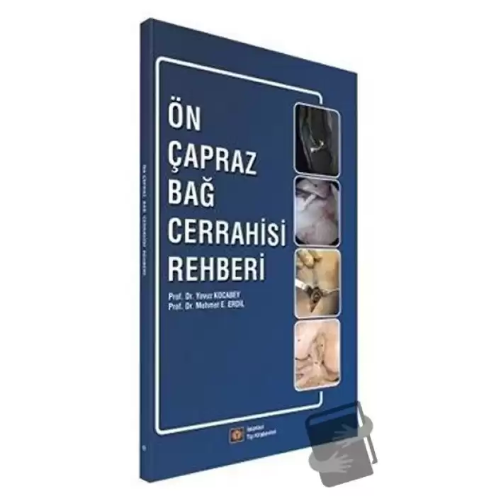 Ön Çapraz Bağ Cerrahisi Rehberi