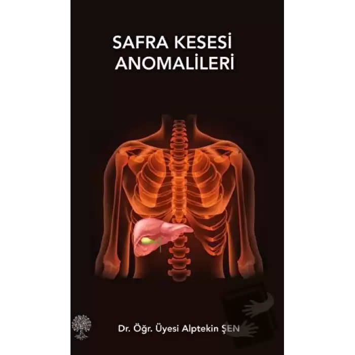 Safra Kesesi Anomalileri