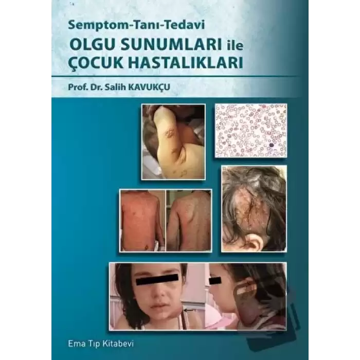 Semptom - Tanı - Tedavi Olgu Sunumları ile Çocuk Hastalıkları (Ciltli)