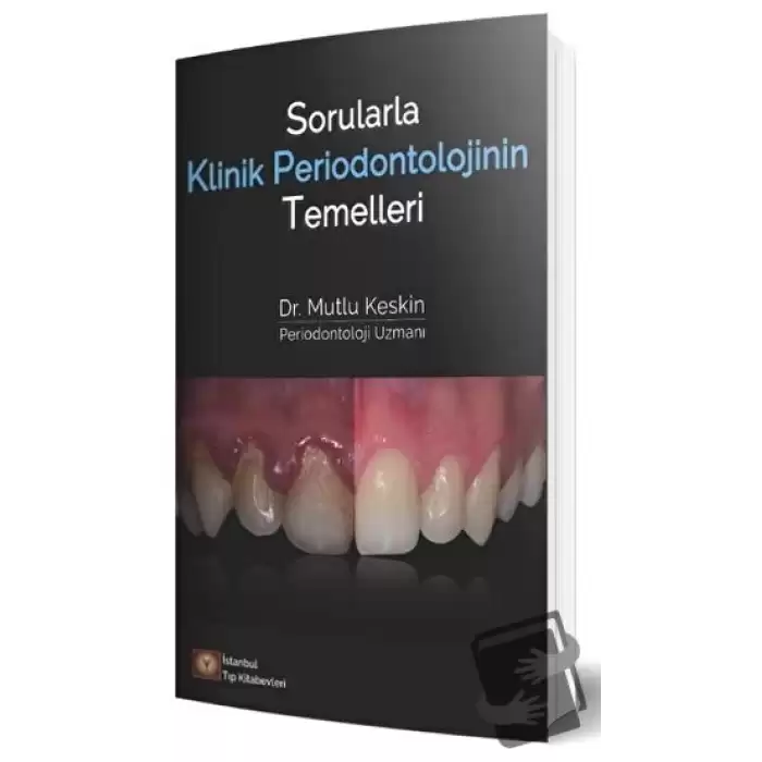 Sorularla Klinik Periodontolojinin Temelleri