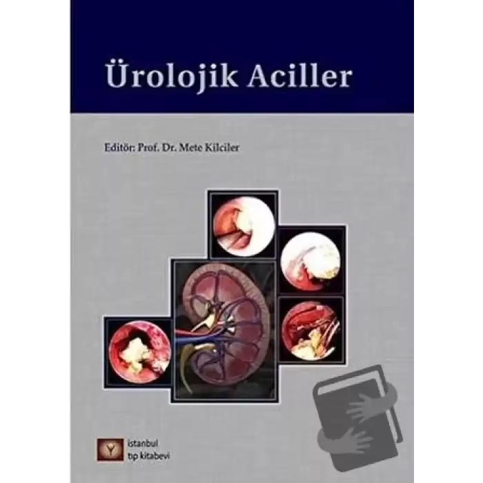 Ürolojik Aciller