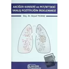 Akciğer Kanseri ve PET/BTdeki Yanlış Pozitifliğin İrdelenmesi