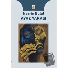 Ayaz Yarası