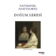 Doğum Lekesi