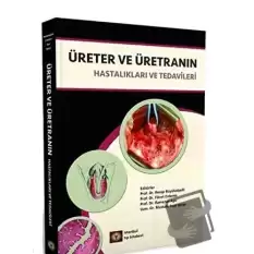 Üreter ve Üretranın Hastalıkları ve Tedavileri