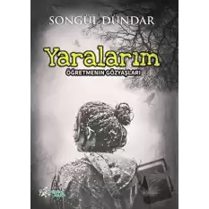 Yaralarım