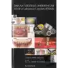 İmplant Destekli Overdenture (Ciltli)