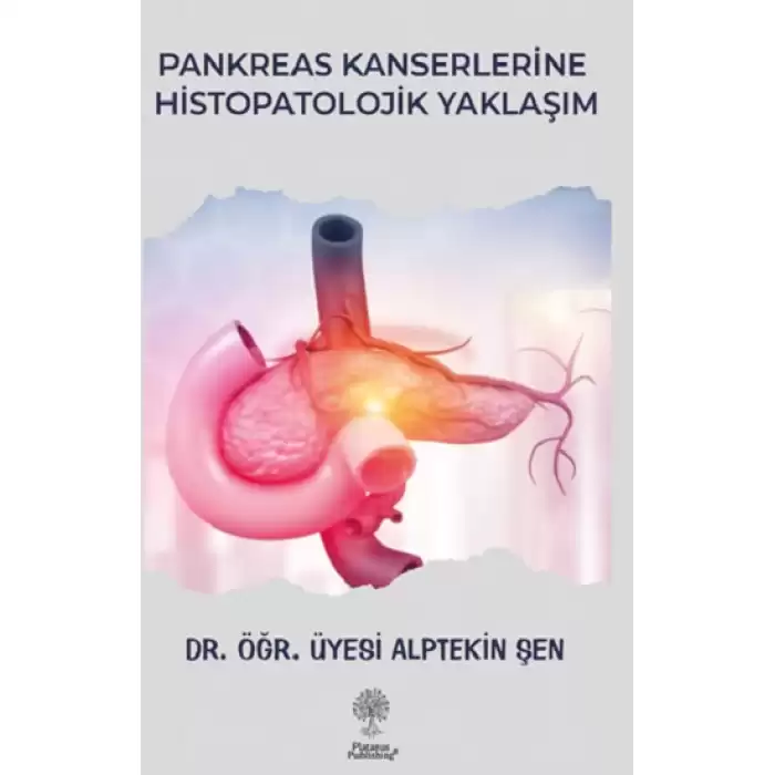 Pankreas Kanserlerine Histopatolojik Yaklaşım