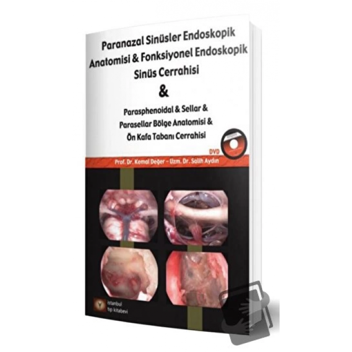 Paranazal Sinüsler Endoskopi Anatomisi & Fonksiyonel Endoskopik Sinüs