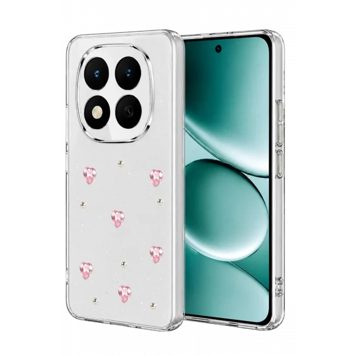 Mey İthalat®   Redmi Note 15 Pro Plus 5G Fiyonk Desenli Kapak - Desen 3