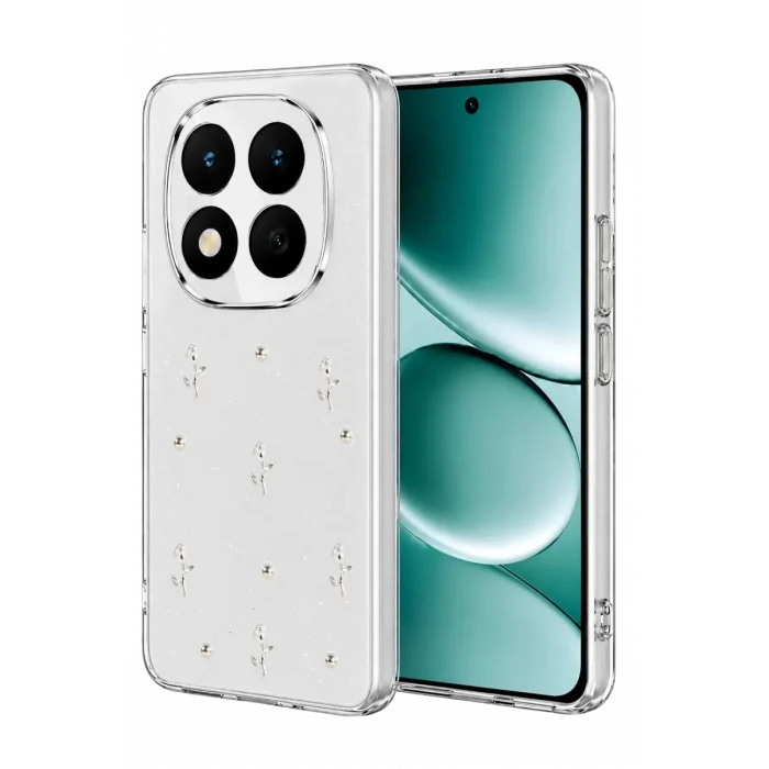 Mey İthalat®   Redmi Note 15 Pro Plus 5G Fiyonk Desenli Kapak - Desen 4