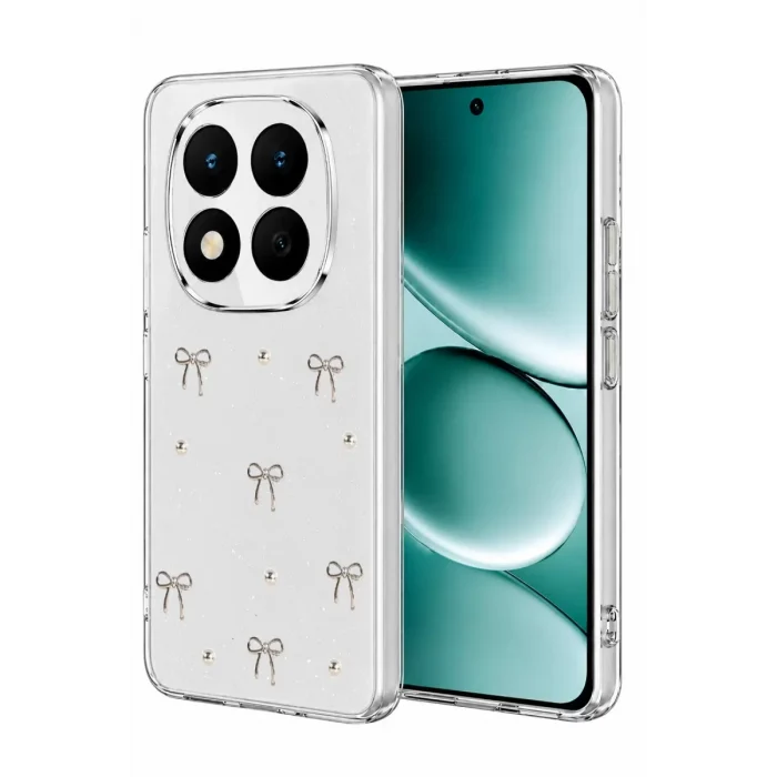 Mey İthalat®   Redmi Note 15 Pro Plus 5G Fiyonk Desenli Kapak - Desen 5