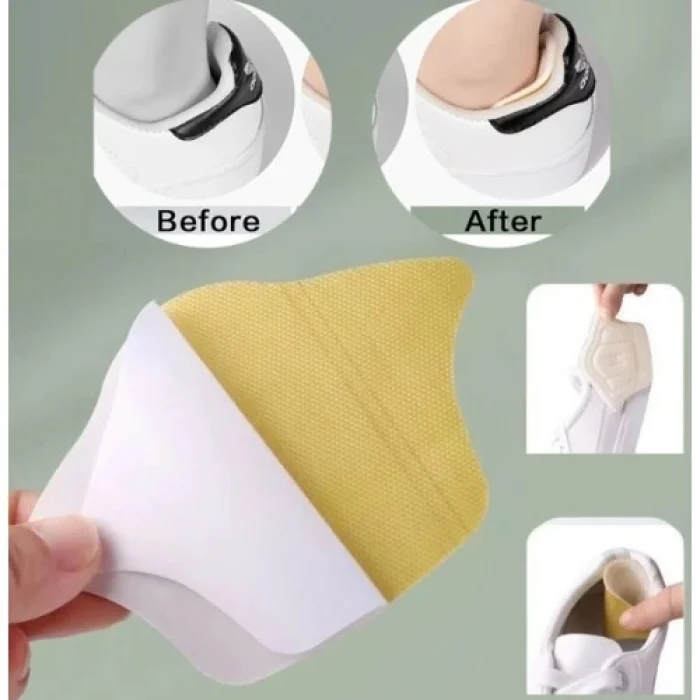 Mey İthalat® Taç Şekilli 5 mm Topuk Daraltma ve Vurma Önleyici