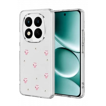 Mey İthalat®   Redmi Note 15 4G Fiyonk Desenli Kapak - Desen 3