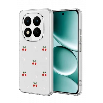 Mey İthalat®   Redmi Note 15 Pro 4G Fiyonk Desenli Kapak - Desen 9