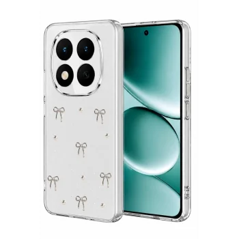 Mey İthalat®   Redmi Note 15 Pro Plus 5G Fiyonk Desenli Kapak - Desen 5