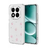 Mey İthalat®   Redmi Note 15 4G Fiyonk Desenli Kapak - Desen 3