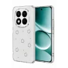 Mey İthalat®   Redmi Note 15 Pro Plus 5G Fiyonk Desenli Kapak - Desen 2