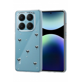 Mey İthalat®   Redmi Note 14 Pro 4G Fiyonk Desenli Kapak - Desen 3