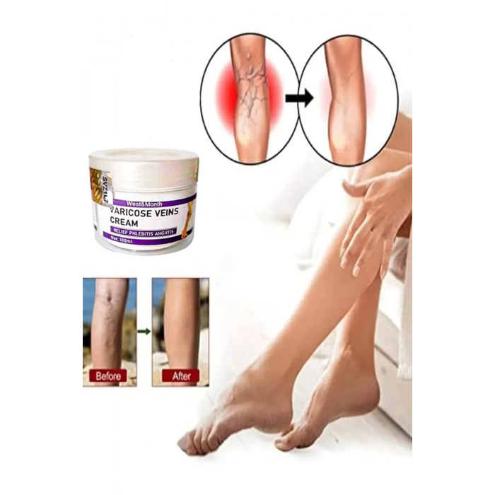 Cream West&Month Selülit Karşıtı Bacak Önleyici Bakım Kremi 100 ml X 2 ADET